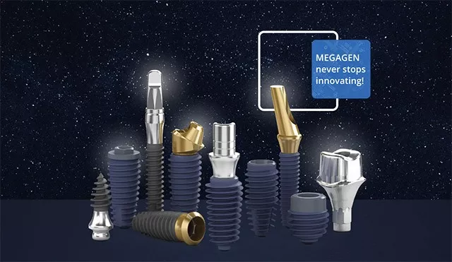 Despre Implant Dentar1