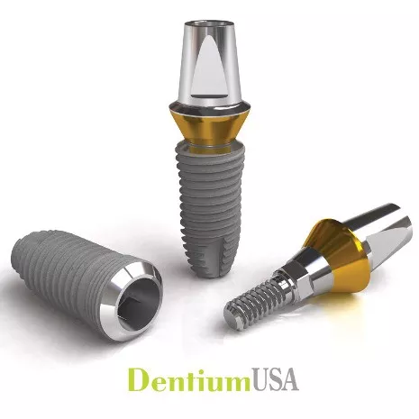 Despre Implant Dentar2