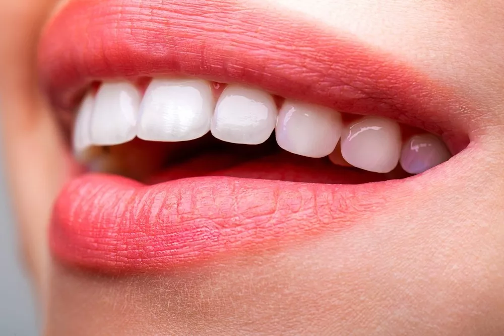 Cum Afecteaza Bruxismul Dintii Si Ce Solutii Poate Oferi O Clinica Dentara Pentru Aceasta Problema1 692e990631db4
